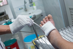 Daily Foot Checks Are Necessary for Diabetic Patients