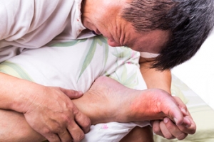 Gout is Arthritis