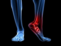 There Are Several Reasons Why Heel Pain May Occur